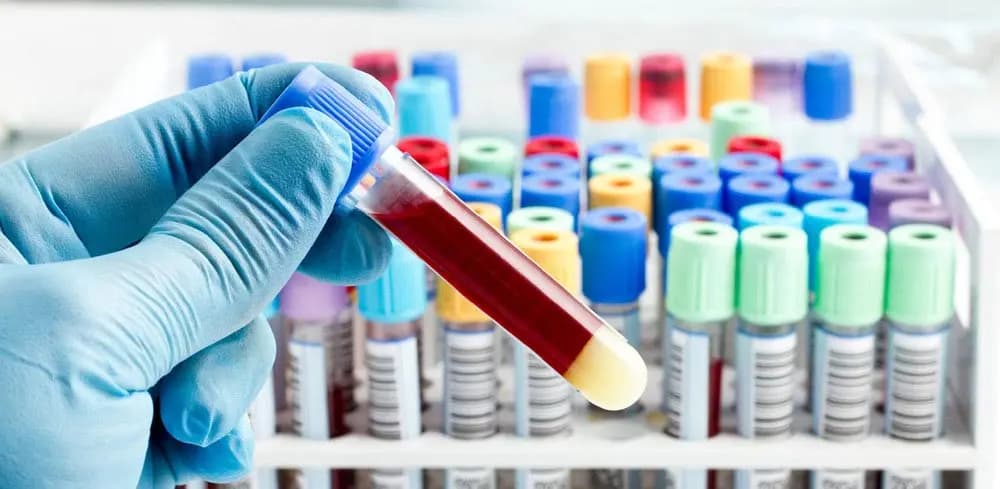 Diagnostics laboratory workflow for corporate wellness programs